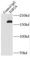 DNA Topoisomerase II Alpha antibody, FNab08868, FineTest, Immunoprecipitation image 