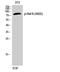 B-Raf Proto-Oncogene, Serine/Threonine Kinase antibody, A00075S602, Boster Biological Technology, Western Blot image 