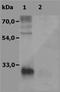 Linker For Activation Of T Cells Family Member 2 antibody, NBP1-44948, Novus Biologicals, Western Blot image 