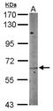 Netrin G1 antibody, NBP2-15047, Novus Biologicals, Western Blot image 