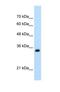 Apolipoprotein B MRNA Editing Enzyme Catalytic Subunit 3D antibody, NBP1-57440, Novus Biologicals, Western Blot image 