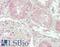 Semaphorin 4D antibody, LS-B14278, Lifespan Biosciences, Immunohistochemistry paraffin image 
