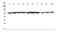 Acid Sensing Ion Channel Subunit 2 antibody, A04055-1, Boster Biological Technology, Western Blot image 