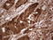 Galectin 9 antibody, LS-C339665, Lifespan Biosciences, Immunohistochemistry paraffin image 