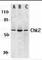 Checkpoint Kinase 2 antibody, 2391, ProSci, Western Blot image 