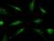 Promyelocytic Leukemia antibody, GTX02306, GeneTex, Immunofluorescence image 