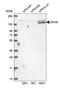 DEAH-Box Helicase 8 antibody, HPA049285, Atlas Antibodies, Western Blot image 