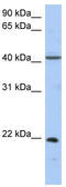 Guanylate kinase antibody, TA336215, Origene, Western Blot image 