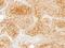 Galactosidase Alpha antibody, NBP2-16576, Novus Biologicals, Immunohistochemistry frozen image 