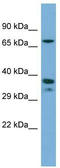 Nuclear receptor subfamily 2 group E member 1 antibody, TA338239, Origene, Western Blot image 