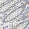 Placental Growth Factor antibody, 16-900, ProSci, Immunohistochemistry frozen image 