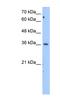 Malate Dehydrogenase 1 antibody, NBP1-54797, Novus Biologicals, Western Blot image 