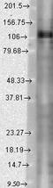 Potassium Voltage-Gated Channel Subfamily C Member 1 antibody, LS-C230736, Lifespan Biosciences, Western Blot image 