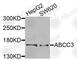ATP Binding Cassette Subfamily C Member 3 antibody, A9849, ABclonal Technology, Western Blot image 