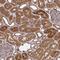 Retinol Dehydrogenase 14 antibody, NBP2-31647, Novus Biologicals, Immunohistochemistry paraffin image 