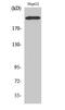 Integrin Subunit Beta 4 antibody, A01015-1, Boster Biological Technology, Western Blot image 