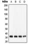 NAD(P)H Quinone Dehydrogenase 1 antibody, LS-C352125, Lifespan Biosciences, Western Blot image 