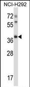 Testis Specific Serine Kinase 6 antibody, PA5-71888, Invitrogen Antibodies, Western Blot image 