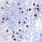 T Cell Leukemia/Lymphoma 1B antibody, PA5-47873, Invitrogen Antibodies, Immunohistochemistry frozen image 