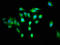 Regulator Of G Protein Signaling 6 antibody, LS-C671080, Lifespan Biosciences, Immunofluorescence image 