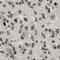 Casein Kinase 2 Alpha 1 antibody, FNab02023, FineTest, Immunohistochemistry paraffin image 