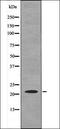 SRC Proto-Oncogene, Non-Receptor Tyrosine Kinase antibody, orb338922, Biorbyt, Western Blot image 