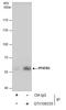 6-phosphofructo-2-kinase/fructose-2,6-biphosphatase 3 antibody, GTX108335, GeneTex, Immunoprecipitation image 