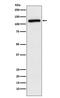 Amyloid Beta Precursor Like Protein 2 antibody, M01232, Boster Biological Technology, Western Blot image 