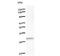 DEAD-Box Helicase 17 antibody, LS-C342705, Lifespan Biosciences, Western Blot image 