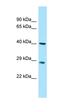 Myozenin 3 antibody, orb326589, Biorbyt, Western Blot image 