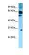 Solute Carrier Family 22 Member 9 antibody, orb326521, Biorbyt, Western Blot image 