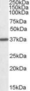 Arginase 1 antibody, abx431108, Abbexa, Western Blot image 