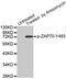 Zeta Chain Of T Cell Receptor Associated Protein Kinase 70 antibody, abx000515, Abbexa, Western Blot image 