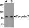 Coronin 7 antibody, LS-C144410, Lifespan Biosciences, Western Blot image 