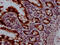 DNA Topoisomerase I antibody, CSB-RA792129A0HU, Cusabio, Immunohistochemistry frozen image 
