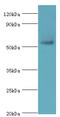 ADPRT3 antibody, MBS1494765, MyBioSource, Western Blot image 