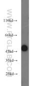 Sprouty Related EVH1 Domain Containing 2 antibody, 24091-1-AP, Proteintech Group, Western Blot image 