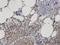 Neutral sphingomyelinase antibody, H00006610-M01, Novus Biologicals, Immunohistochemistry paraffin image 
