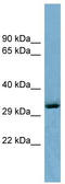 OTU Domain Containing 6B antibody, TA345081, Origene, Western Blot image 