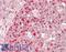 Karyopherin Subunit Alpha 2 antibody, LS-B14865, Lifespan Biosciences, Immunohistochemistry paraffin image 