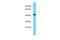 KIAA0513 antibody, PA5-46026, Invitrogen Antibodies, Western Blot image 