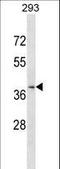 C-C Motif Chemokine Receptor Like 2 antibody, LS-C168494, Lifespan Biosciences, Western Blot image 