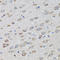 Proteasome 26S Subunit, Non-ATPase 10 antibody, LS-C331784, Lifespan Biosciences, Immunohistochemistry frozen image 