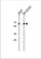 Iroquois-class homeodomain protein IRX-3 antibody, TA324554, Origene, Western Blot image 