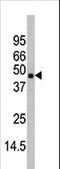 Mitogen-Activated Protein Kinase 11 antibody, LS-C100715, Lifespan Biosciences, Western Blot image 