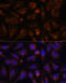 AKT Serine/Threonine Kinase 2 antibody, 14-464, ProSci, Immunofluorescence image 