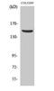 Par-3 Family Cell Polarity Regulator antibody, A01897-1, Boster Biological Technology, Western Blot image 