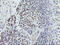 p53 antibody, M00001-5, Boster Biological Technology, Immunohistochemistry paraffin image 