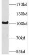 SET Domain Bifurcated Histone Lysine Methyltransferase 2 antibody, FNab07772, FineTest, Western Blot image 