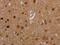 MDM2 Binding Protein antibody, MBS2524074, MyBioSource, Immunohistochemistry paraffin image 